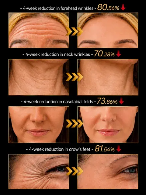 LED Anti-Wrinkle Mask 4