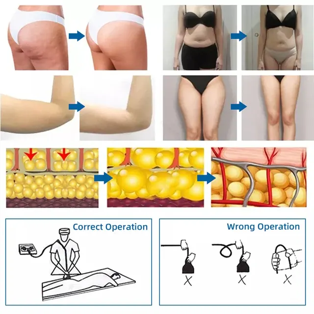 RF Vibration Body Shaper 4