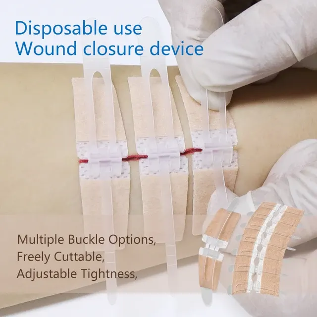 Sutureless Wound Closure Device Zip Stitch Bandage Emergency 2