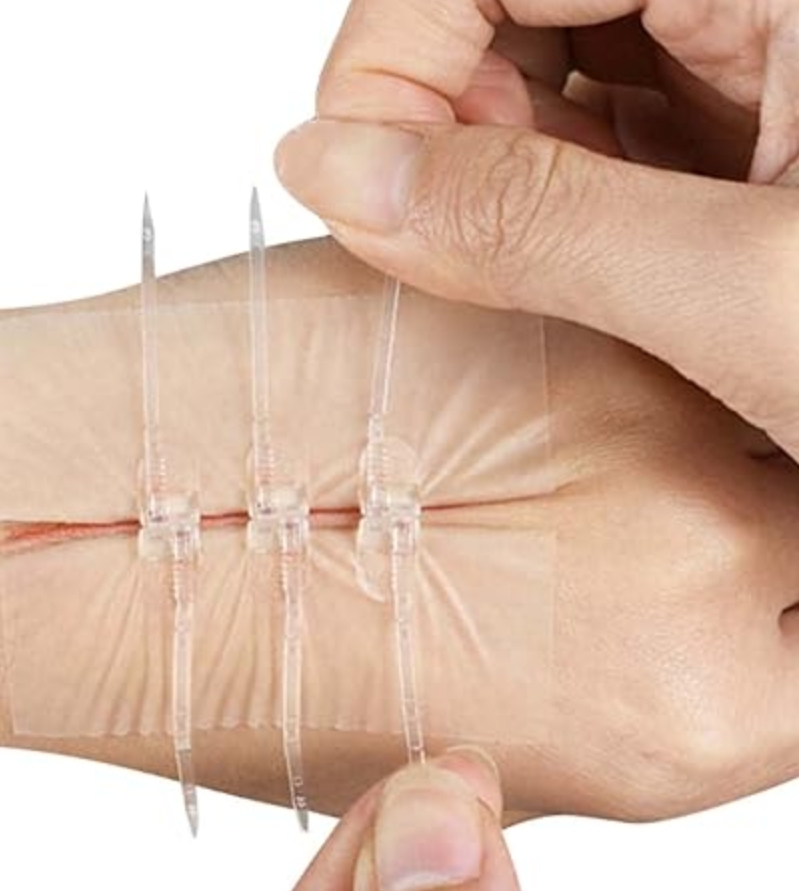 Emergency Wound Closure Devices Zipper Strips Laceration Kits
