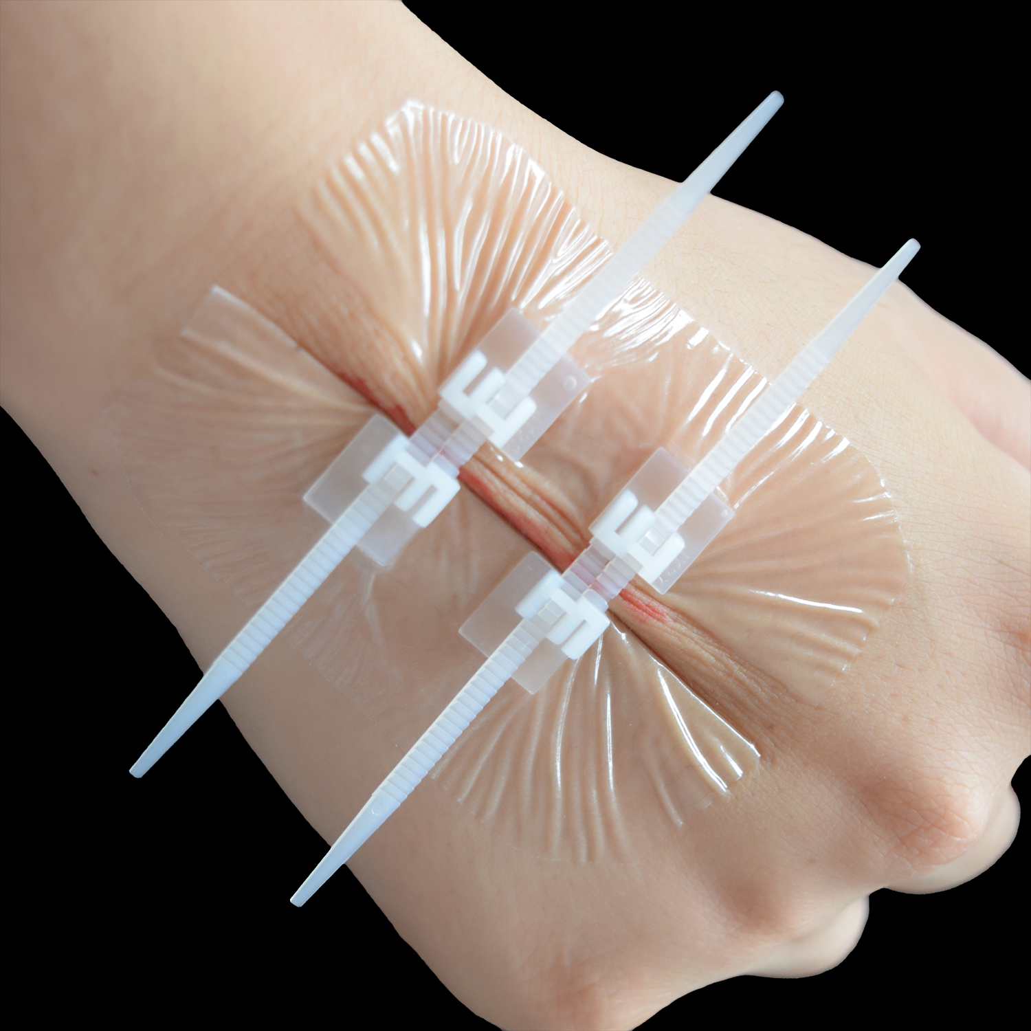 Painless Zipper Wound Closure Strip Suture-Free Emergency Laceration 3