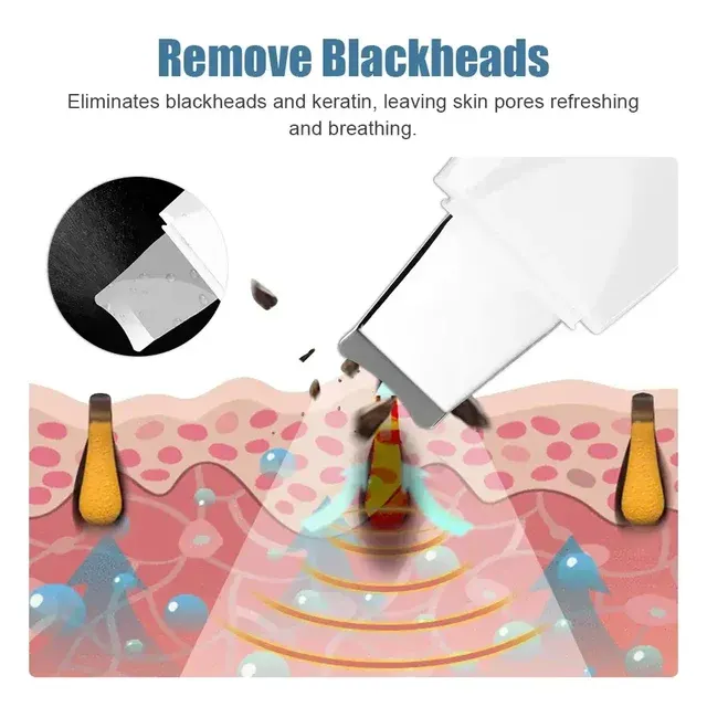Skin Peeling Device 2