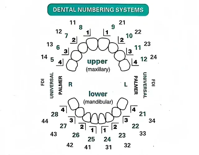 Dental Veneer Mold Set 3