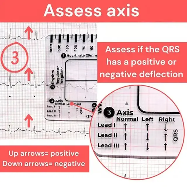 ECG Ruler Card 3