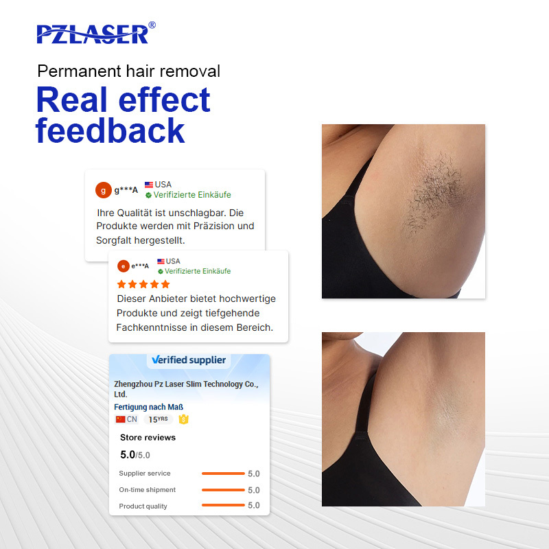 Permanent Diode Laser Hair Remover 755/808/1064nm 4