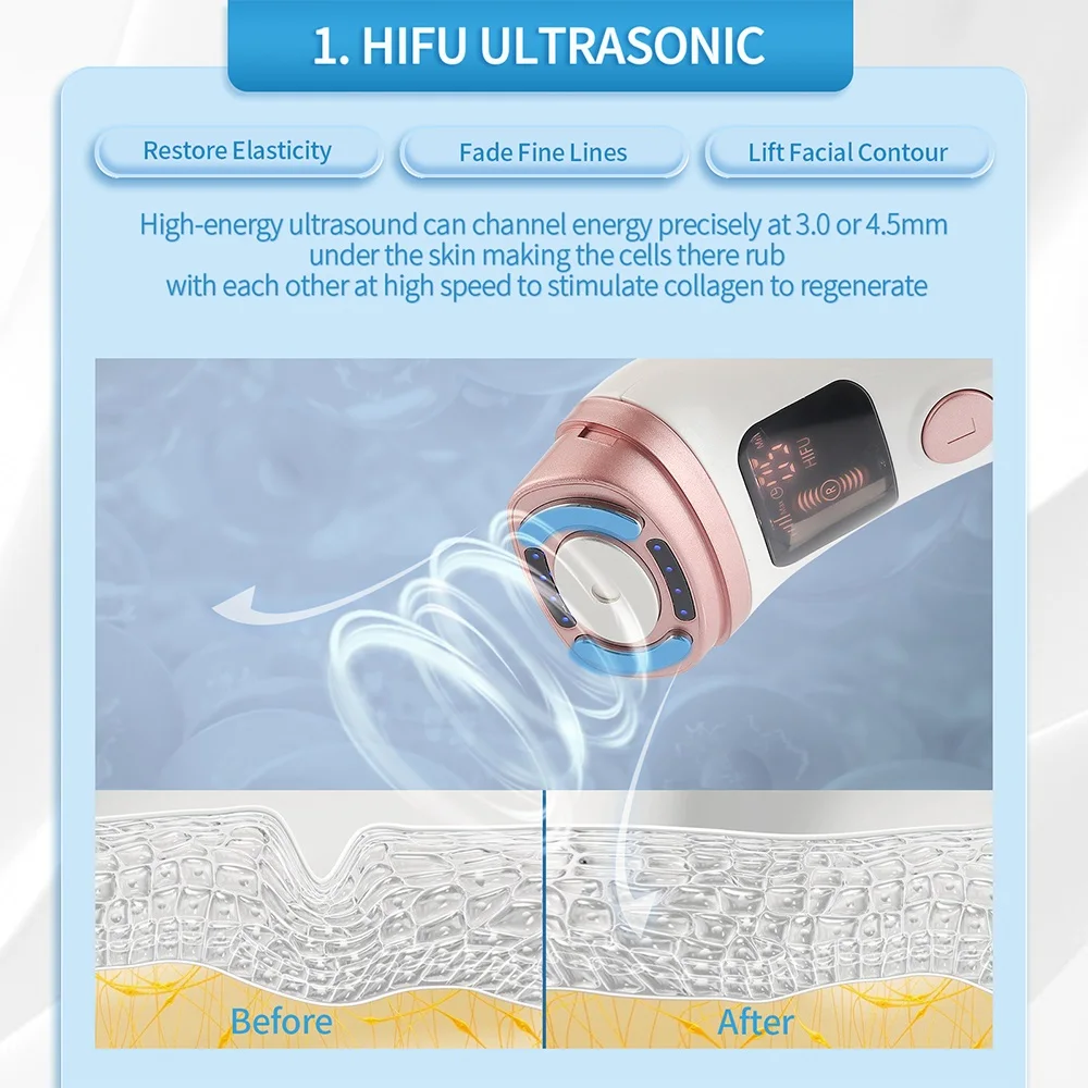 Mini HIFU Maschine Ultraschall RF EMS Gesichts Lifting 4
