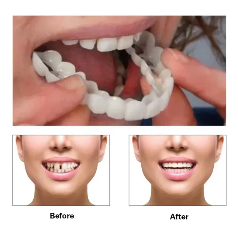 Silicone Temporary Tooth Replacement Set 3