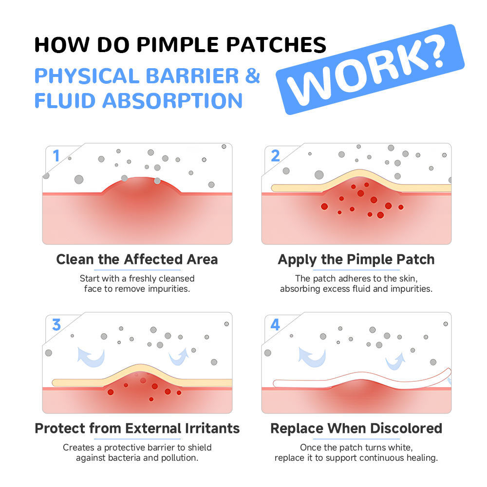 Skin Friendly Invisible Hydrocolloid Acne Patch Waterproof Gentle 4