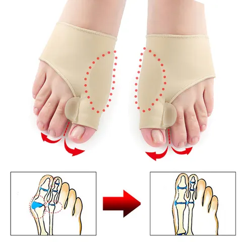 Big Toe Bunion Corrector Splint Straightener Valgus Pain