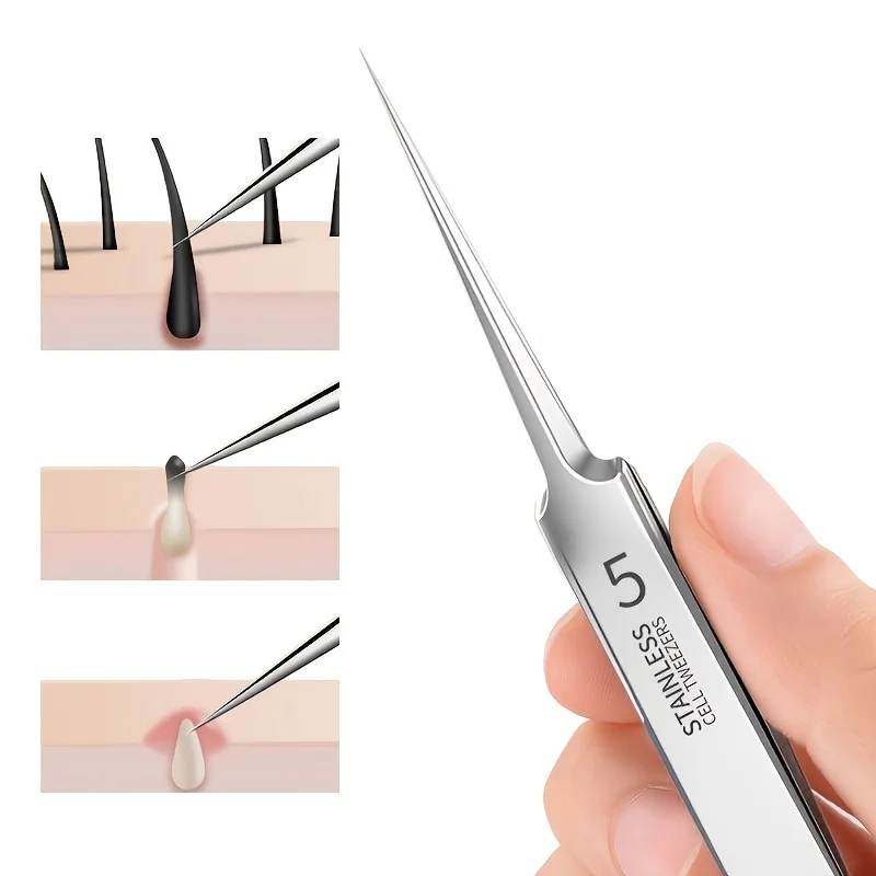 Extra-Fine No. 5 Blackhead Tweezers 2