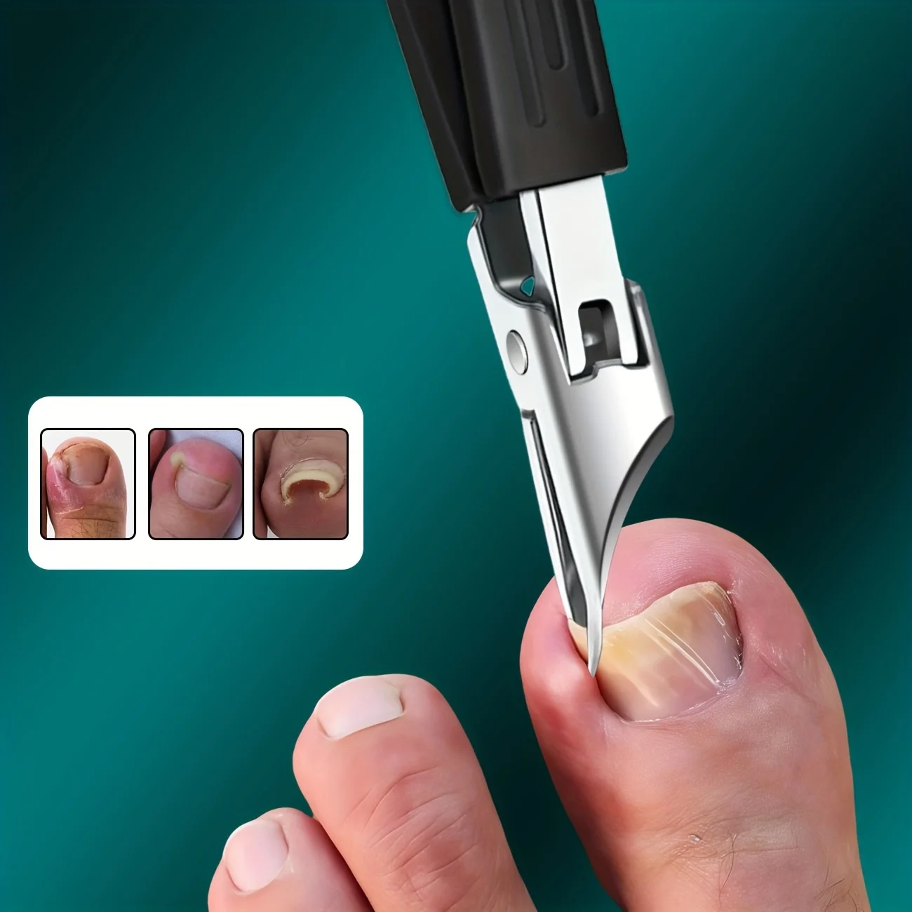 Robuster Edelstahl-Nagelknipser für Eingewachsene Nägel mit Sicherheits-Softgriff Ultrascharfer