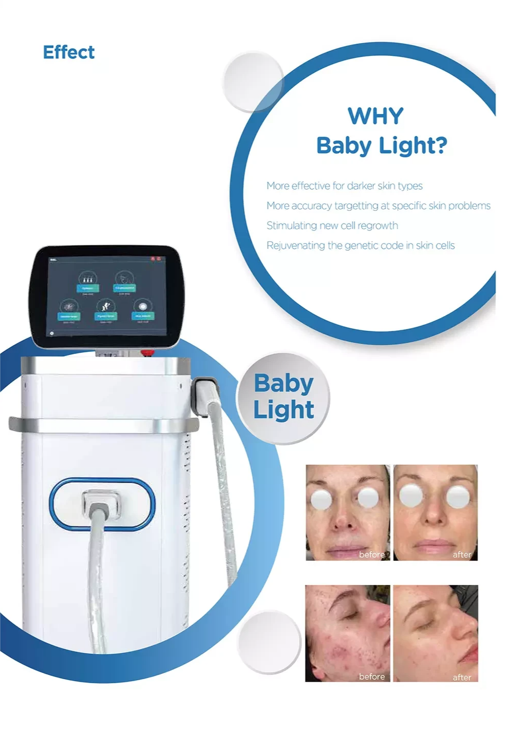 Professional IPL Hair Removal Machine for Salons 4