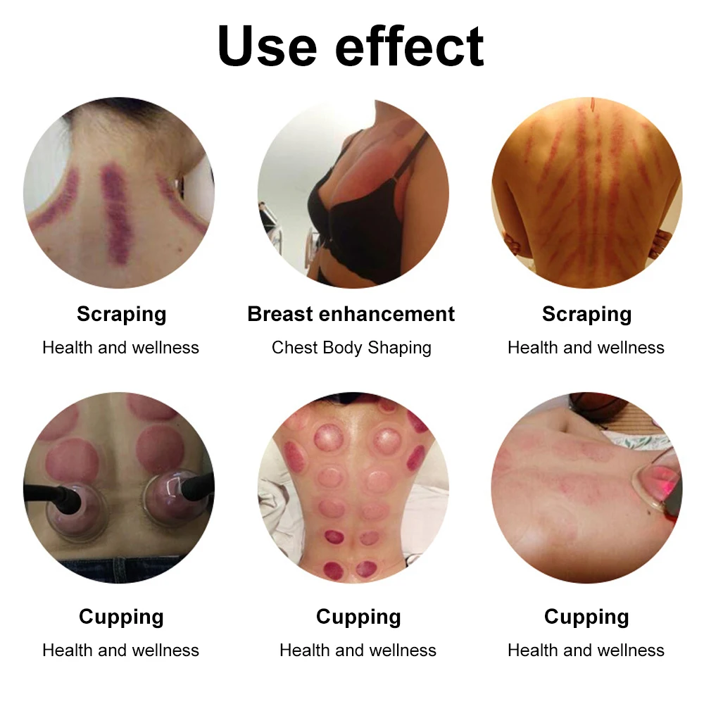 AOKO 35 Cups Vakuumtherapiegerät zur Brustvergrößerung Körperformung Hüftverstärkung 4