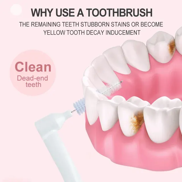 Orthodontic Interdental Brush 2