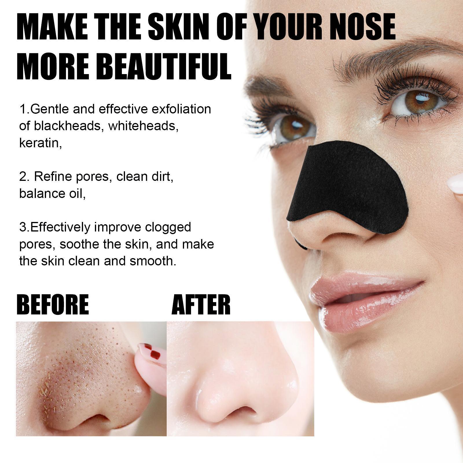 10 Pcs Blackhead Nose Strips Set