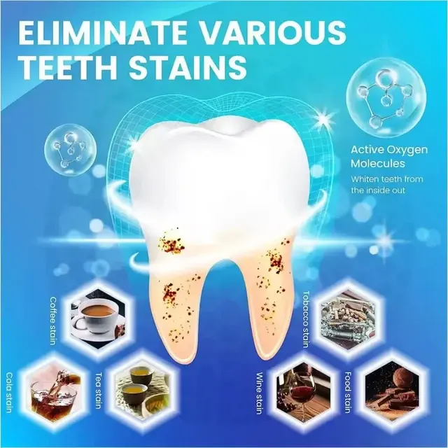 Teeth Whitening Strips 2