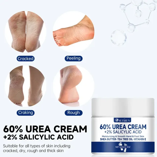 60% Urea Foot Cream for Cracked Heels 4