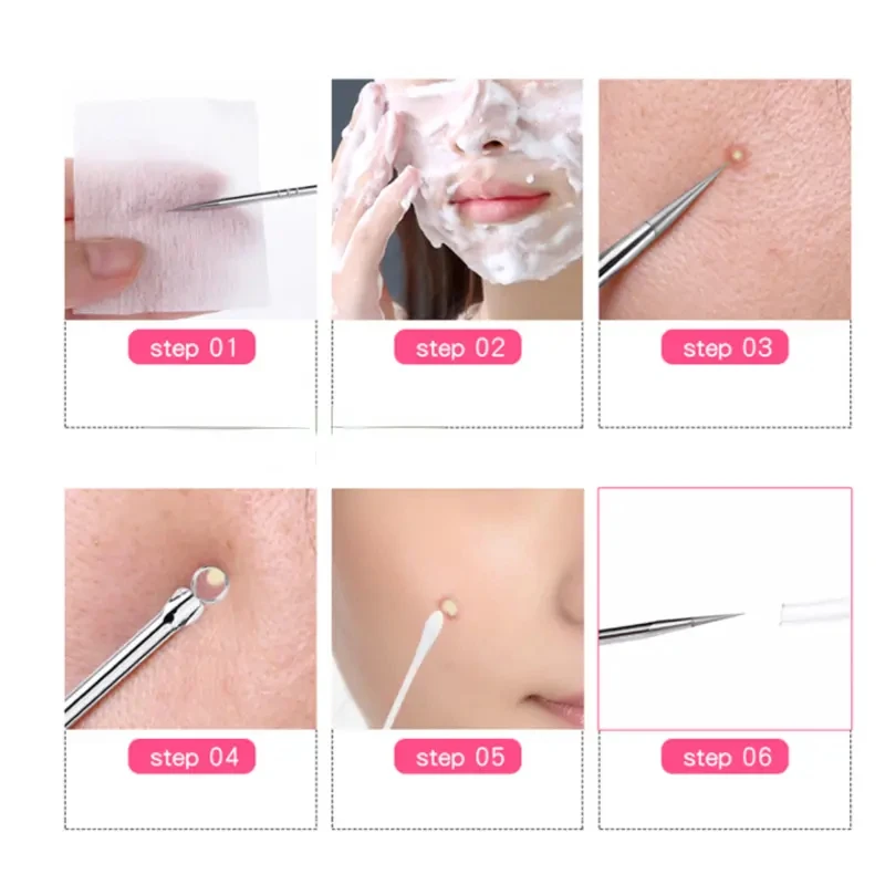 Stainless Steel Blackhead Extractor Kit 2