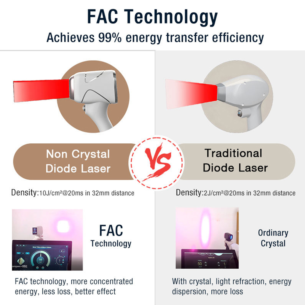 Dynamic AI Diode Laser Hair Removal Device 2